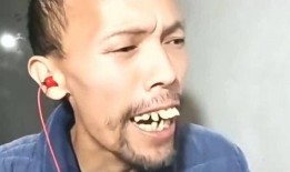 掉牙大叔最新爆料视频,最新爆料视频背后的惊人真相